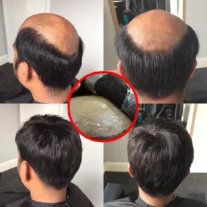 What Is Fully Taping for Men