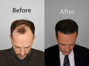 What Is Hair Weaving Services in Muscat