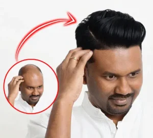 What Is Hair Weaving services for Men