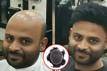 Best Hair Wig for Cancer Patients
