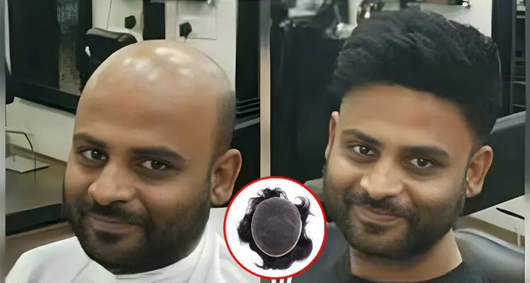 Best Hair Wig for Cancer Patients