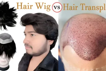 Hair Wig vs Transplant Which Is Better