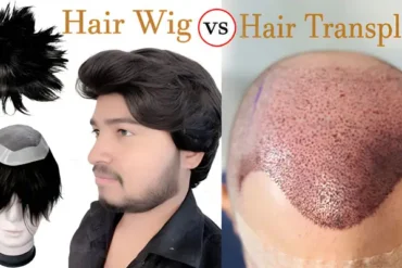 Hair Wig vs Transplant Which Is Better