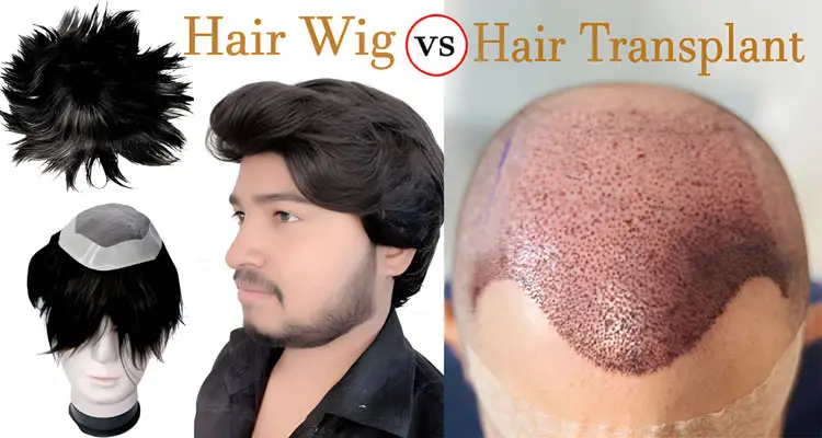 Hair Wig vs Transplant Which Is Better