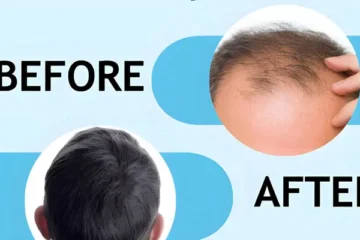 Know How Long Does Hair Fixing Last