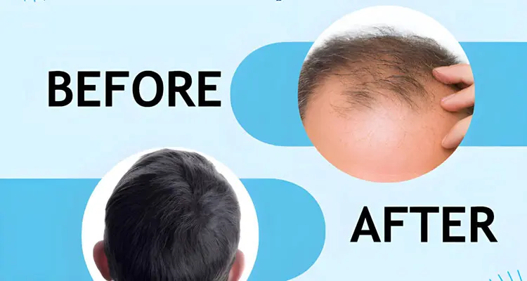 Know How Long Does Hair Fixing Last