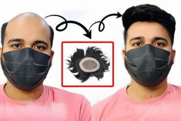 Non-Surgical Hair Transplant Cost in Oman
