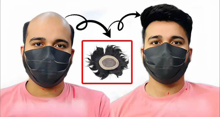 Non-Surgical Hair Transplant Cost in Oman
