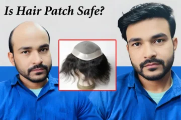 Is Hair Patch Safe Benefits Muscat Oman