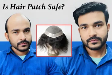 Is Hair Patch Safe Benefits Muscat Oman