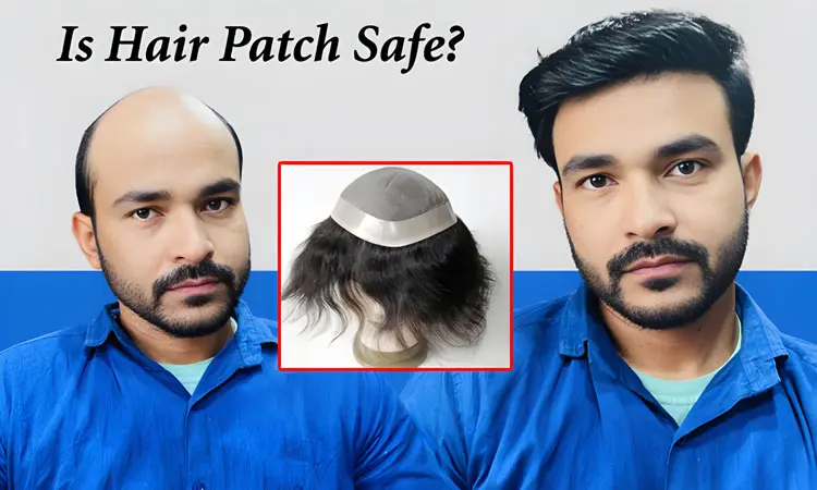 Is Hair Patch Safe Benefits Muscat Oman