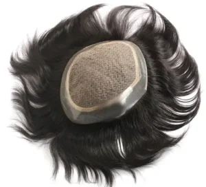 What Is Hair Patch Service in Oman