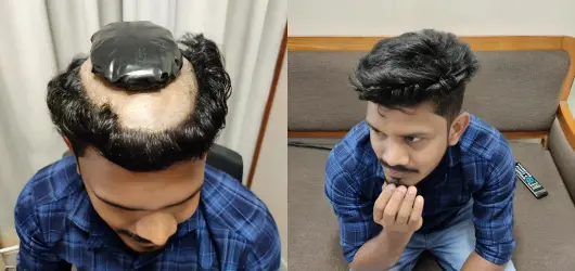 Hair System Services