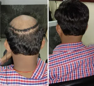 Hair weaving services in Oman
