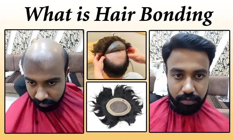 Know What is Hair Bonding by Smart Hair Fixing