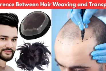 Hair Weaving and Transplant by Smart Hair Fixing