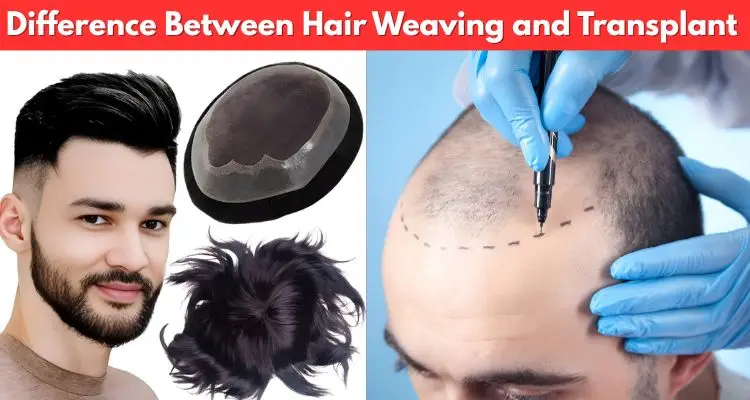 Hair Weaving and Transplant by Smart Hair Fixing