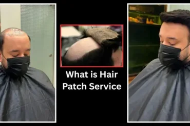 What is Hair Patch Service with Smart Hair Fixing