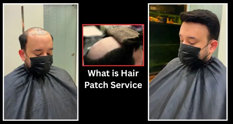 What is Hair Patch Service with Smart Hair Fixing