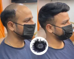 Hair Fixing Muscat Reviews